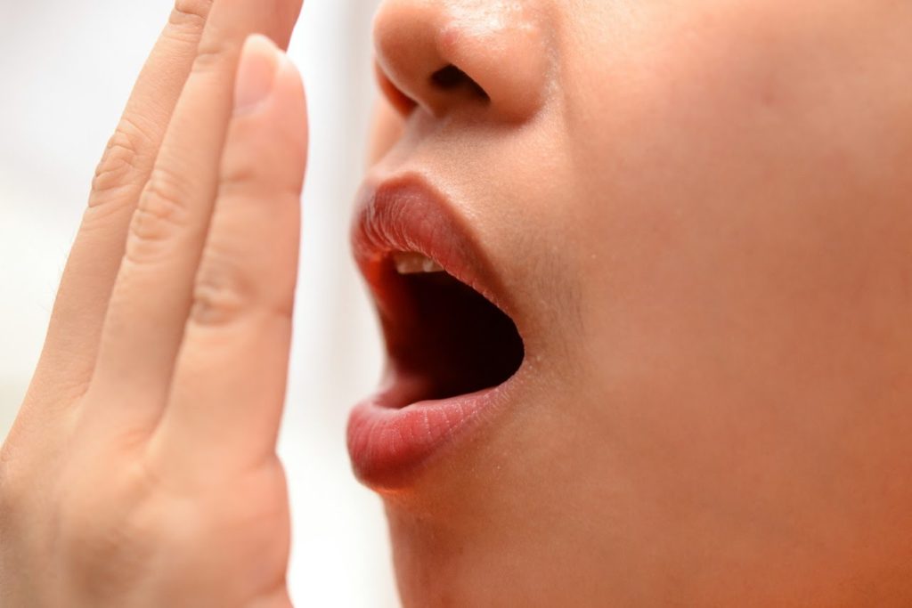 Traitement de la mauvaise haleine/ halitose. Possibilités de traitement